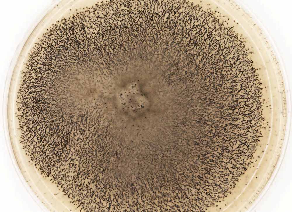 Возбудитель антракноза сои Colletotrichum truncatum в лаборатории НИЦ